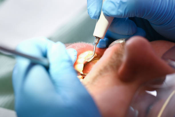 Best Emergency Gum Treatment in Sylvan Lake, MI